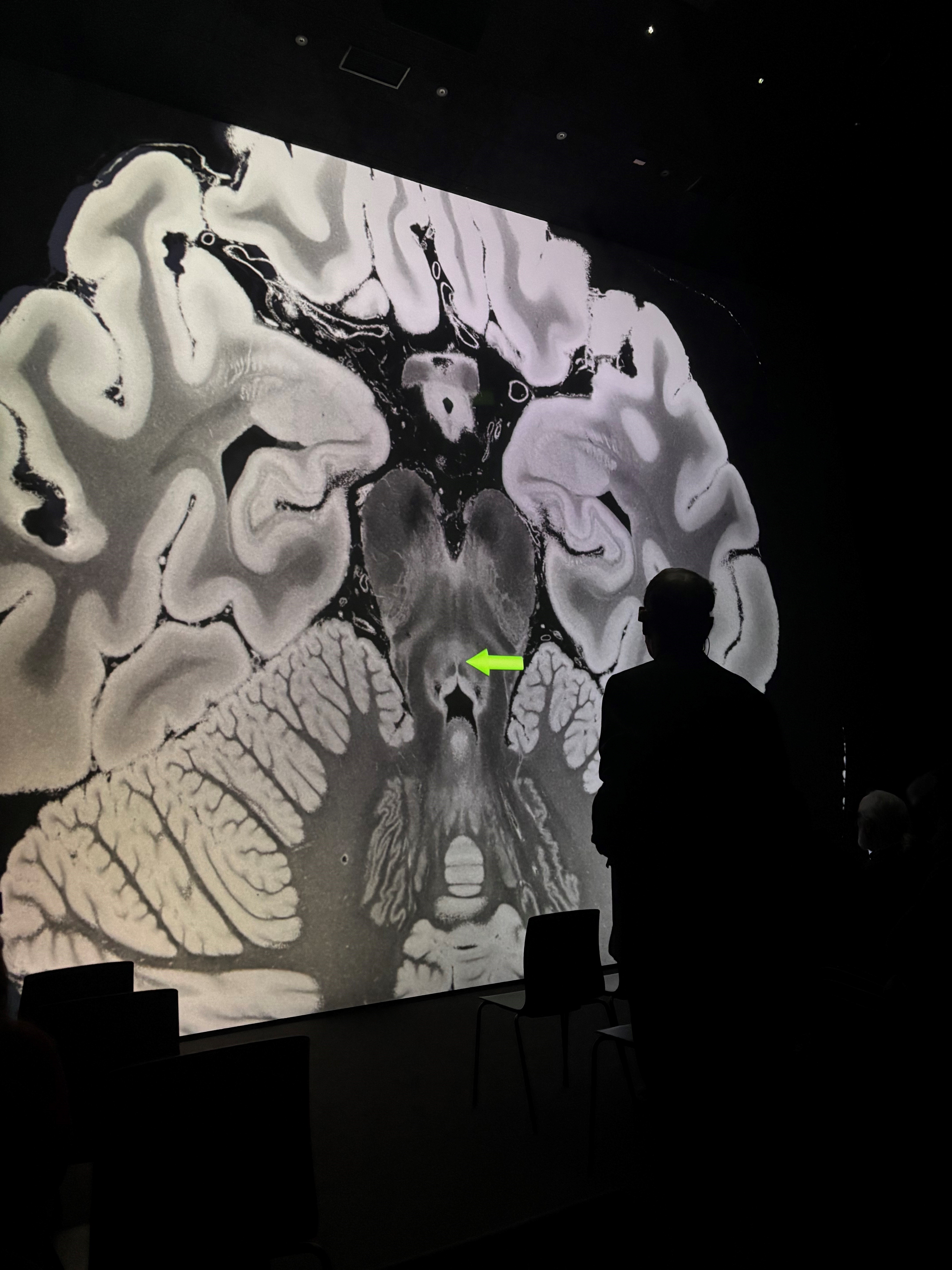 Prim. Univ.-Prof. Dr. Fellner anlässlich seines Fachbeitrags “3D Anatomy for Clinical Neuroimaging”